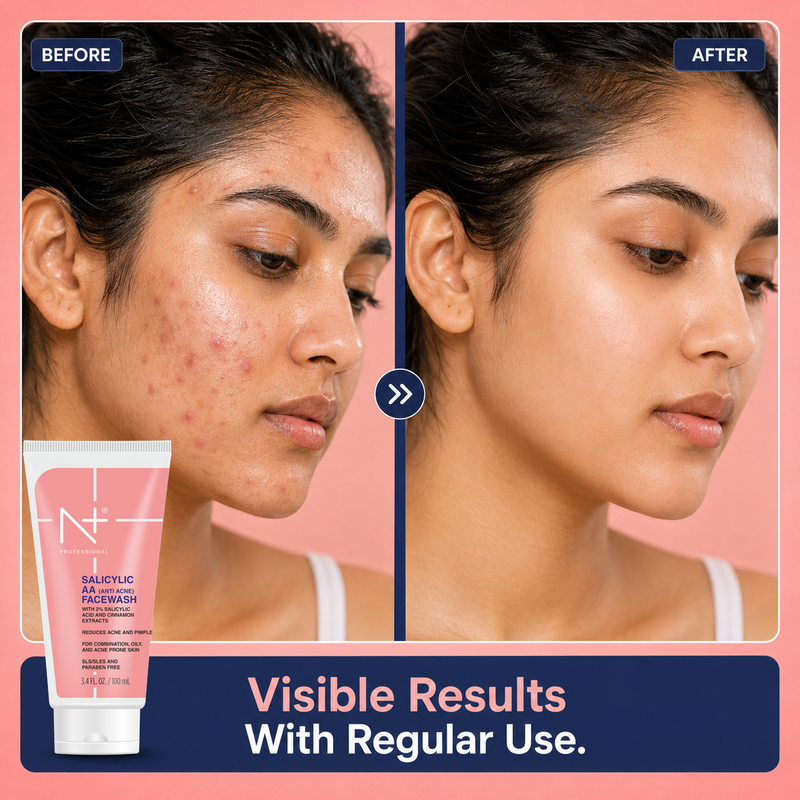Salicylic AA (Anti Acne) Facewash, Reduce Acne & Pimple, SLS & Paraben Free- 100ml