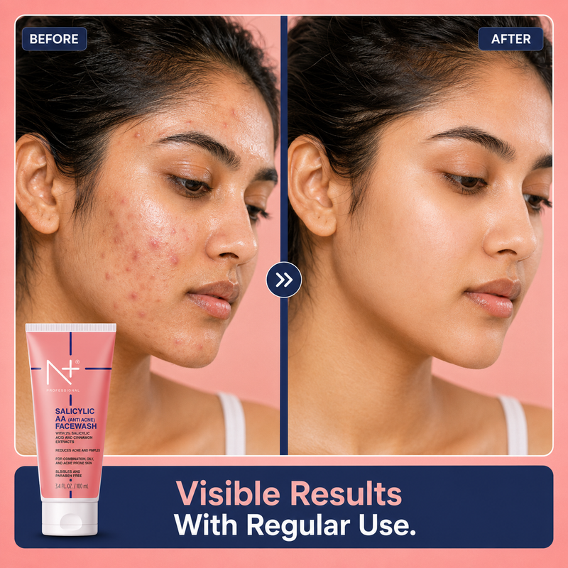 Salicylic AA (Anti Acne) Facewash, Reduce Acne & Pimple, SLS & Paraben Free- 100ml